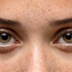 É confiável fazer exame de vista em ótica?